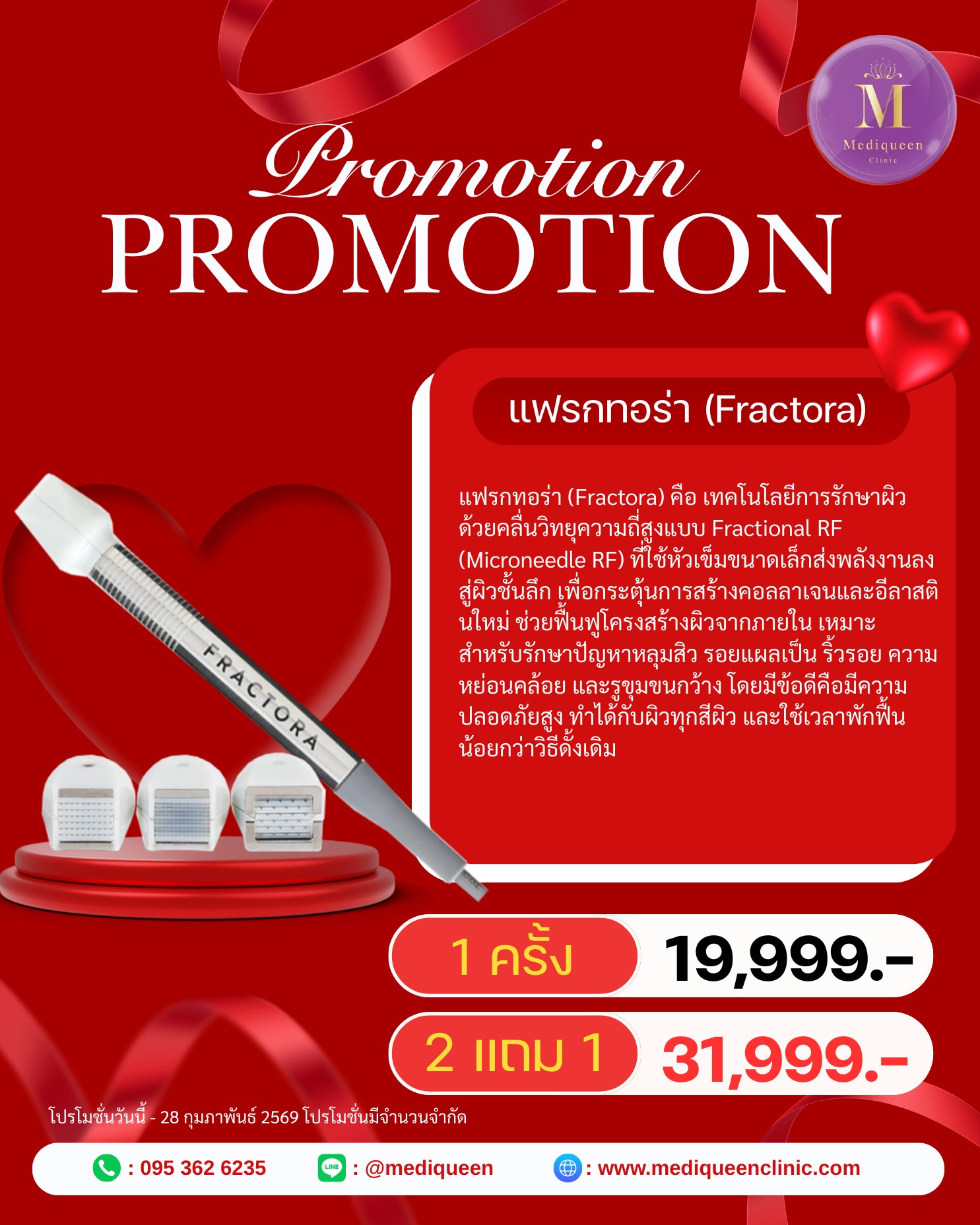 Promotion 4