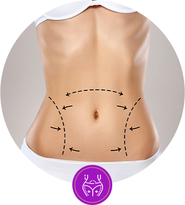 ดูดไขมัน