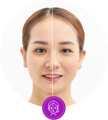 ชะลอวัย